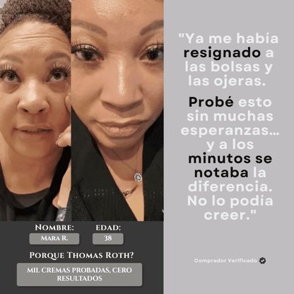 ThomasRoth™– Mirada Firme al Instante + Regalo