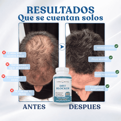 DHT Blocker – Crecimiento Capilar + Kit Completo 🩺