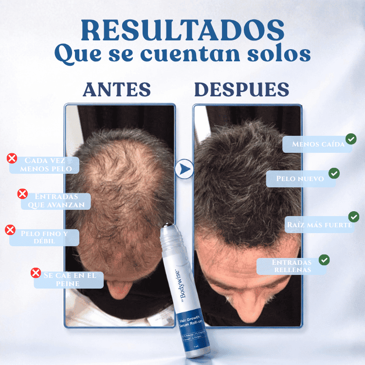 BodyWise™ – Crecimiento Capilar + Kit Completo 🩺